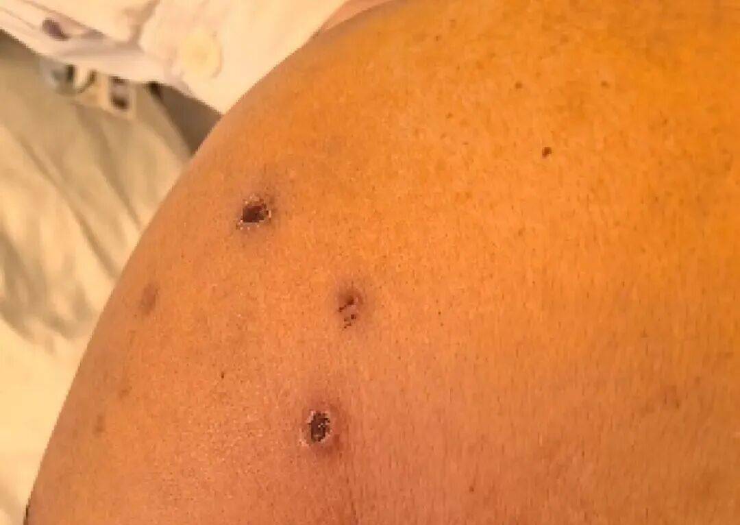 深圳一市民突遭马蜂围袭！已进入高发期，千万别招惹！